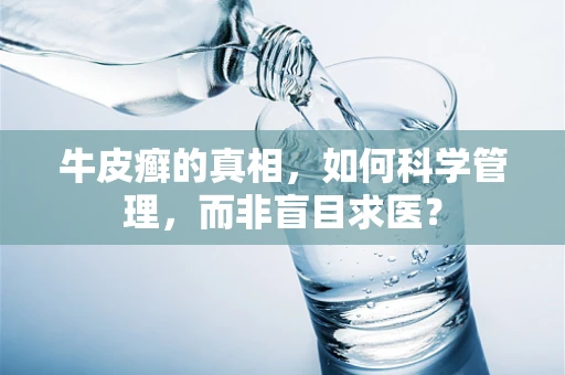 牛皮癣的真相，如何科学管理，而非盲目求医？